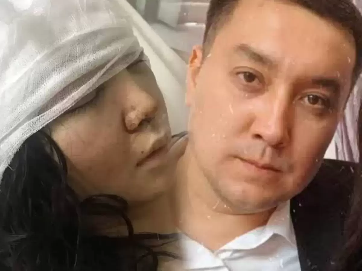 "Анашым, мен өліп барам": күйеуінің соққысынан тірі қалған Алтынайдың оқиғасы