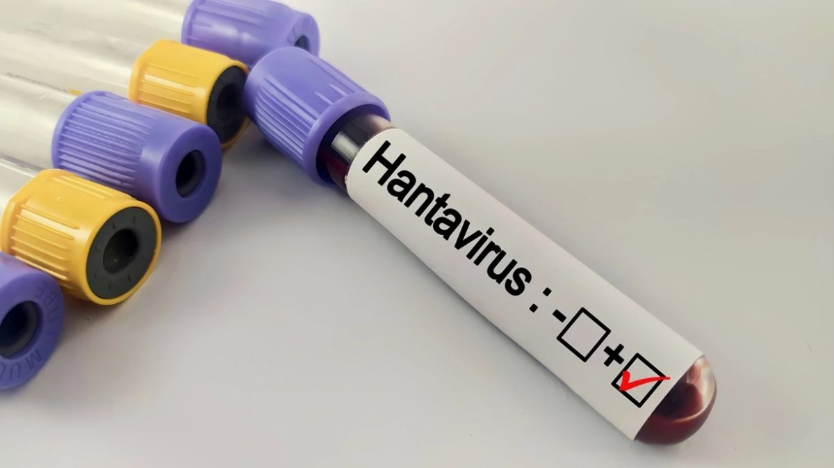 COVID-19 ізімен: Хантавирустың өршуіне қатысты байлам айтылды