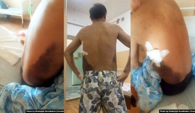 Талдықорғанда полицейлер азаматтың тоғыз қабырғасы мен төсін сындырған